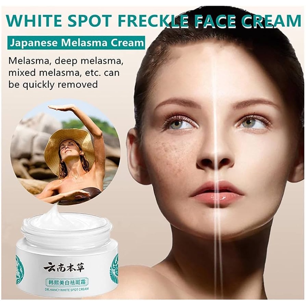 BEST SEVER Japanese Melasma Cream White Spot Cream Skin Care Face