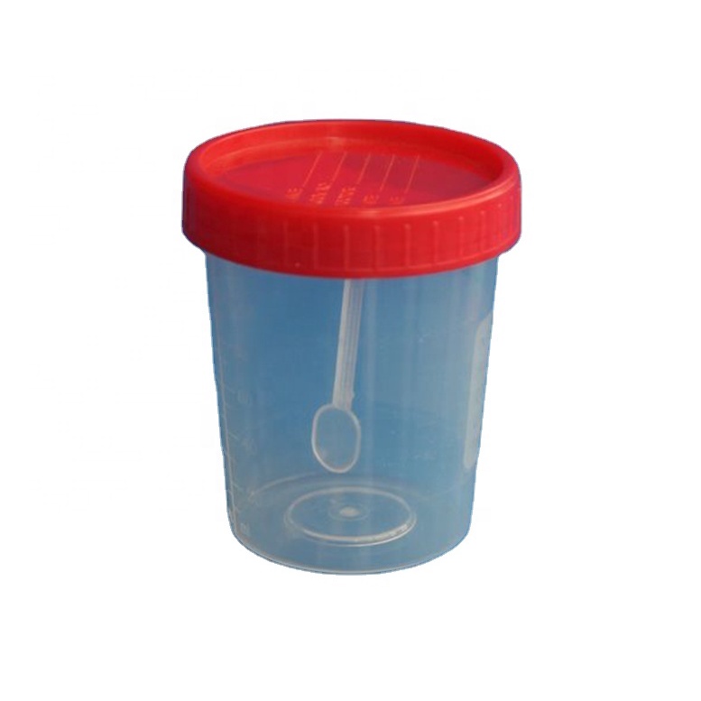 Lab Consumables Disposable Stool Container Cup Specimen Container ...