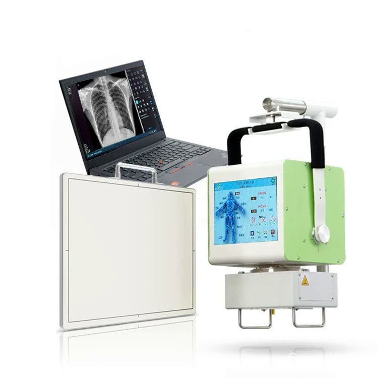 DR digital Xray 100mA 5KW Mini X ray Radiography Machine with Touch ...