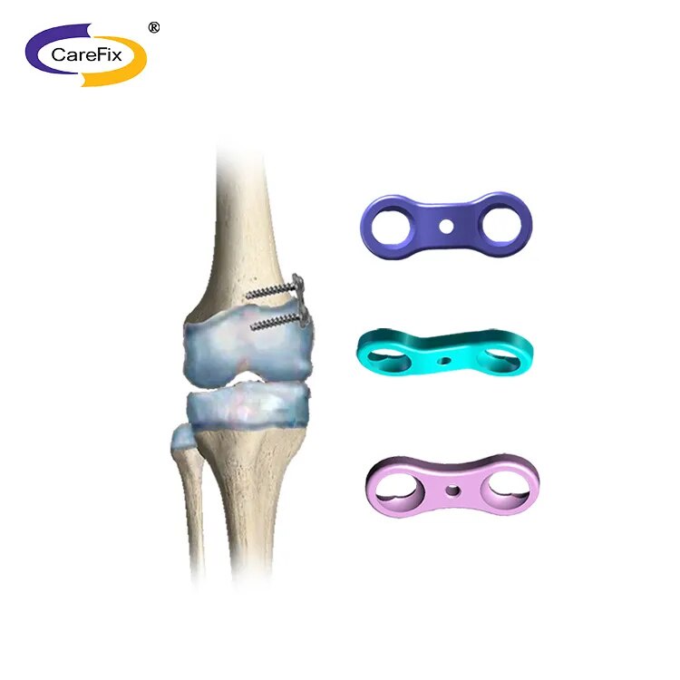 Bone Surgical Instruments Orthopedic Plate Pediatric Internal Fixation ...