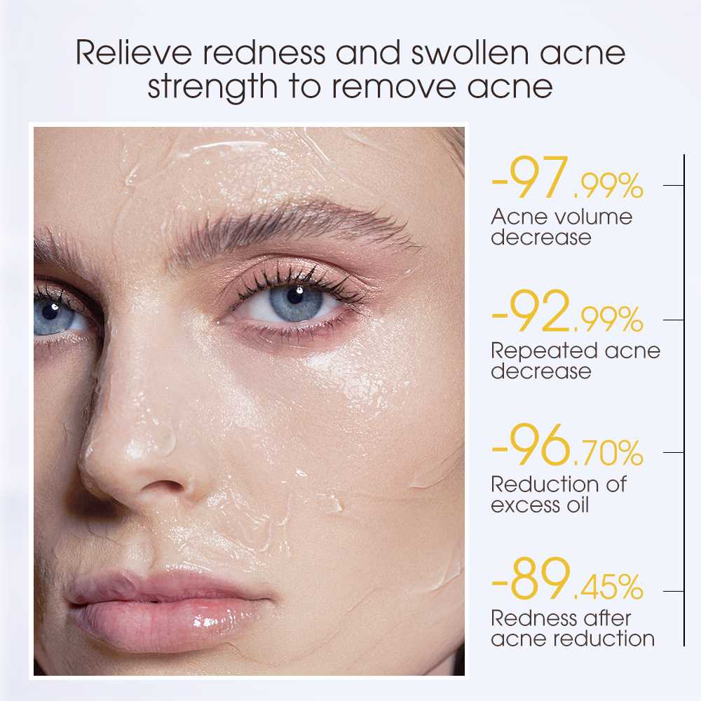 SKINEVER Salicylic Acid Acne Treatment Ice Sleep Masque Anti Acne Anti