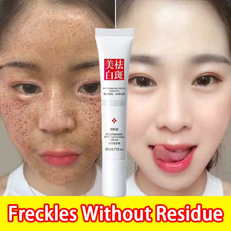 melasma and pekas remover cream original from japan japanese collagen