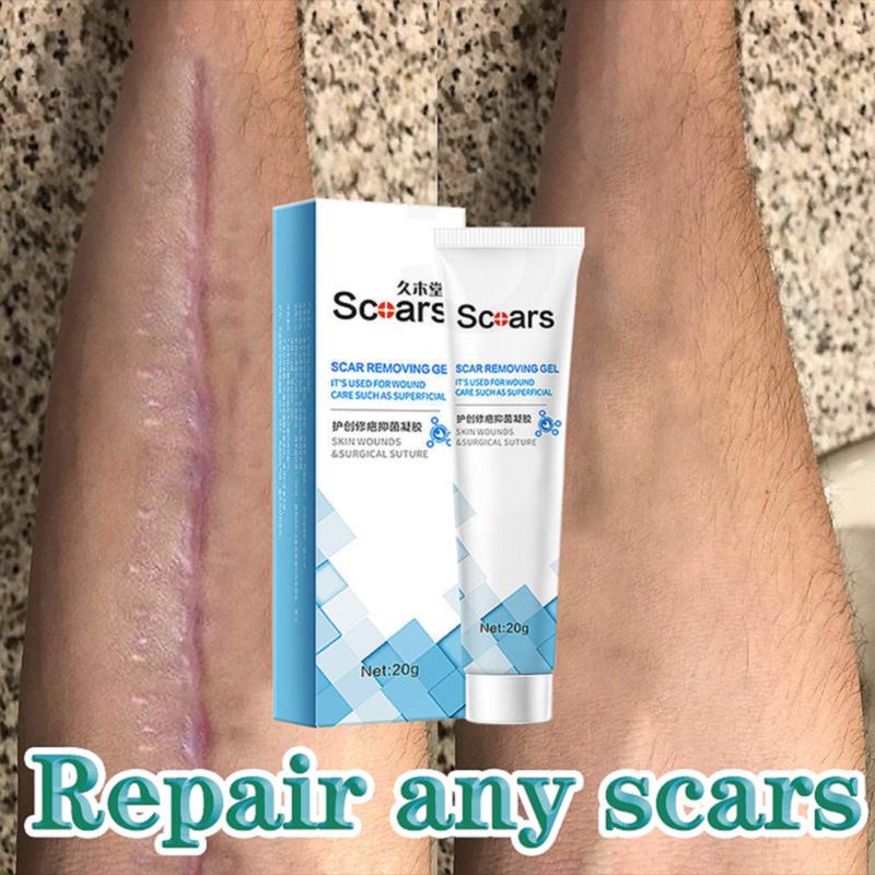 K850 100 Effective keloid Scar Remover cream scar gel original