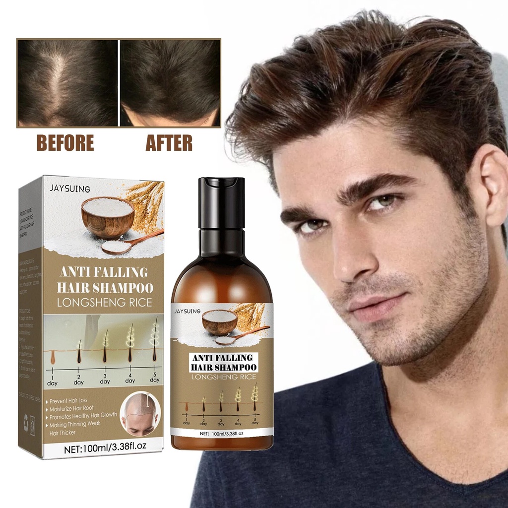 57G Anti Hair Loss Shampoo Remove Dandruff Anti-itch Scalp Treatment ...