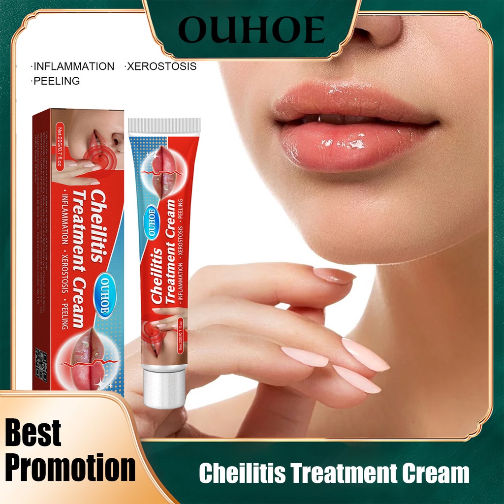 Y Sores Ointment Rehydration Lipstick Cheilitis Cream Lip Cold
