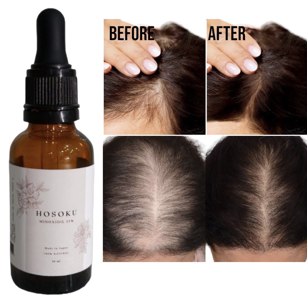 HOSOKU MINOXIDIL 15 ORIGINALMinoxidil is a to with collagen and castor