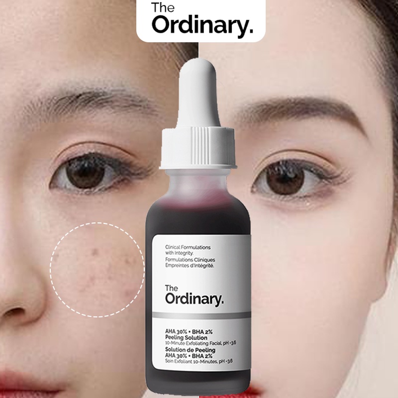 The Ordinary AHA 30 BHA 2 Peeling Solution Peeling Lotion For Face ...