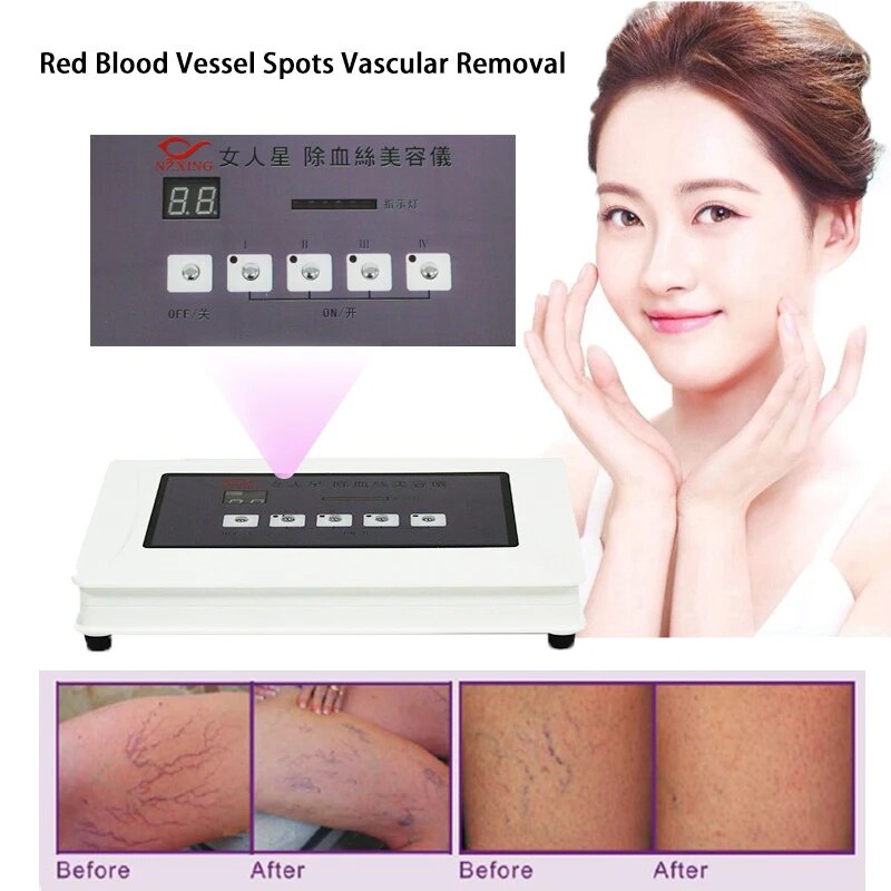 86r High Frequency Spider Veins Removal Device Remove Facial Thread