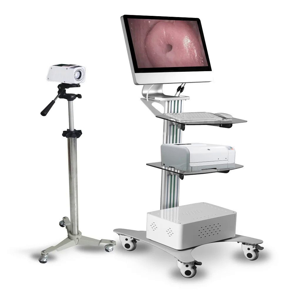 YSSW3306 low price gynecological high resolution digital colposcope ...