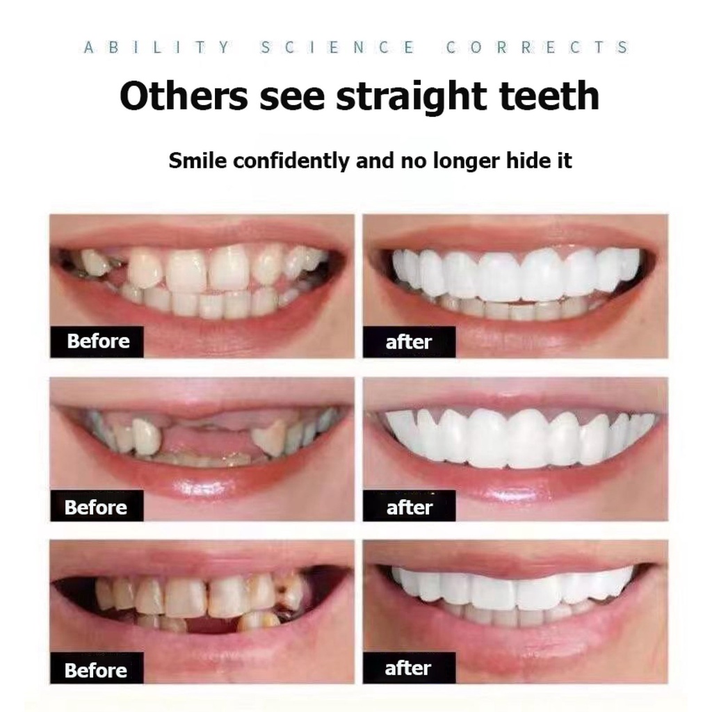 pustiso teeth ready to wear Cosmetic Teeth Bright White Shade Upper