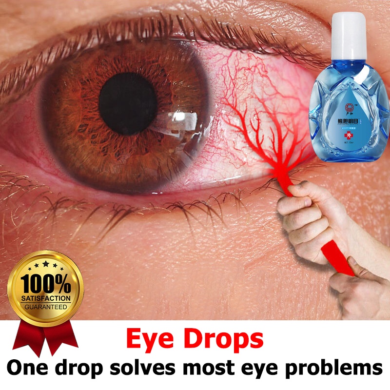 eye drops antibacterial sore eyes eye drops opticare miracle eye drops