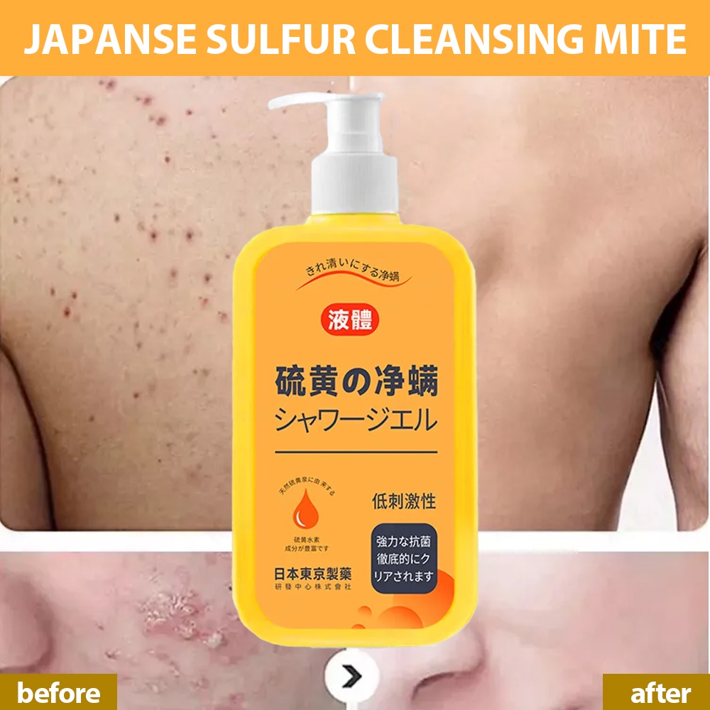 Japanse Sulfur Cleansing Mite Sulfur Bady Wash Mite Sulfur Liquid Soap