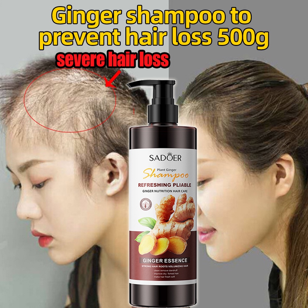 Sadoer Ginger Shampoo And Conditioner For Stronger Hair Roots And Anti ...