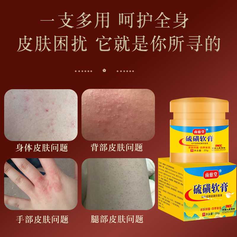 Baocao Sulfur Ointment Hair Follicle Net Crab Louse Cream Anti-Itching ...