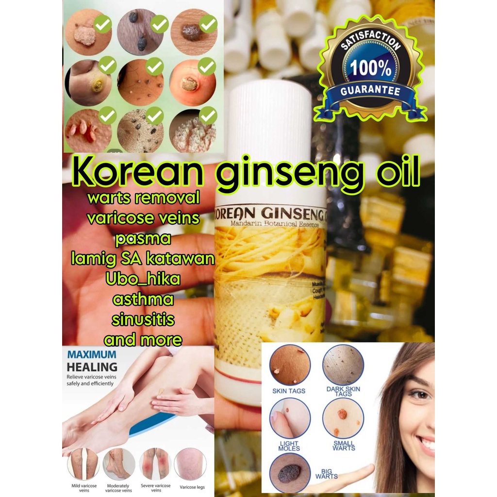 Korean ginseng oil 60ml warts Varicose veins lamig SA katawan rayuma