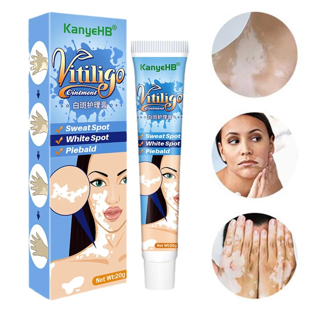 95g 20g Herbal Extract Vitiligo Ointment Remove Ringworm White Spot Removal Skin White Spot Le