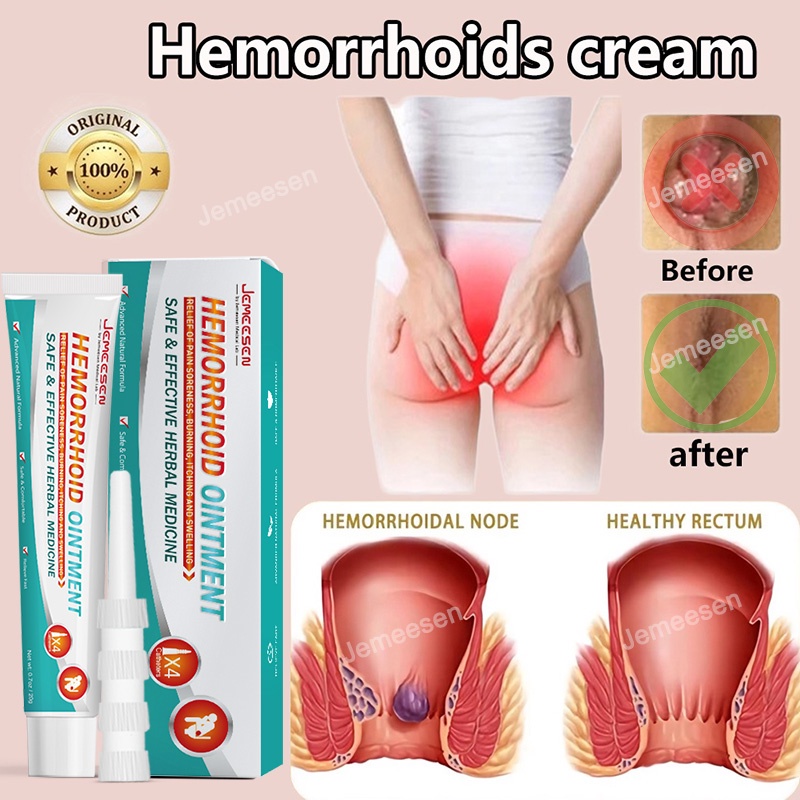 Hemorrhoids Cream Original relieve itching burning, pain or discomfort ...