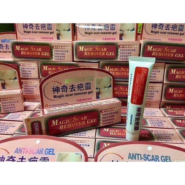 【Hot Sale】MAGIC Scar Remover Effective Magic Scar Mabisang pangtanggal ...
