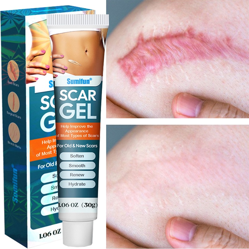 COD.Scar cream Scar Removal Cream Repair Stretch Marks Burn Surgical