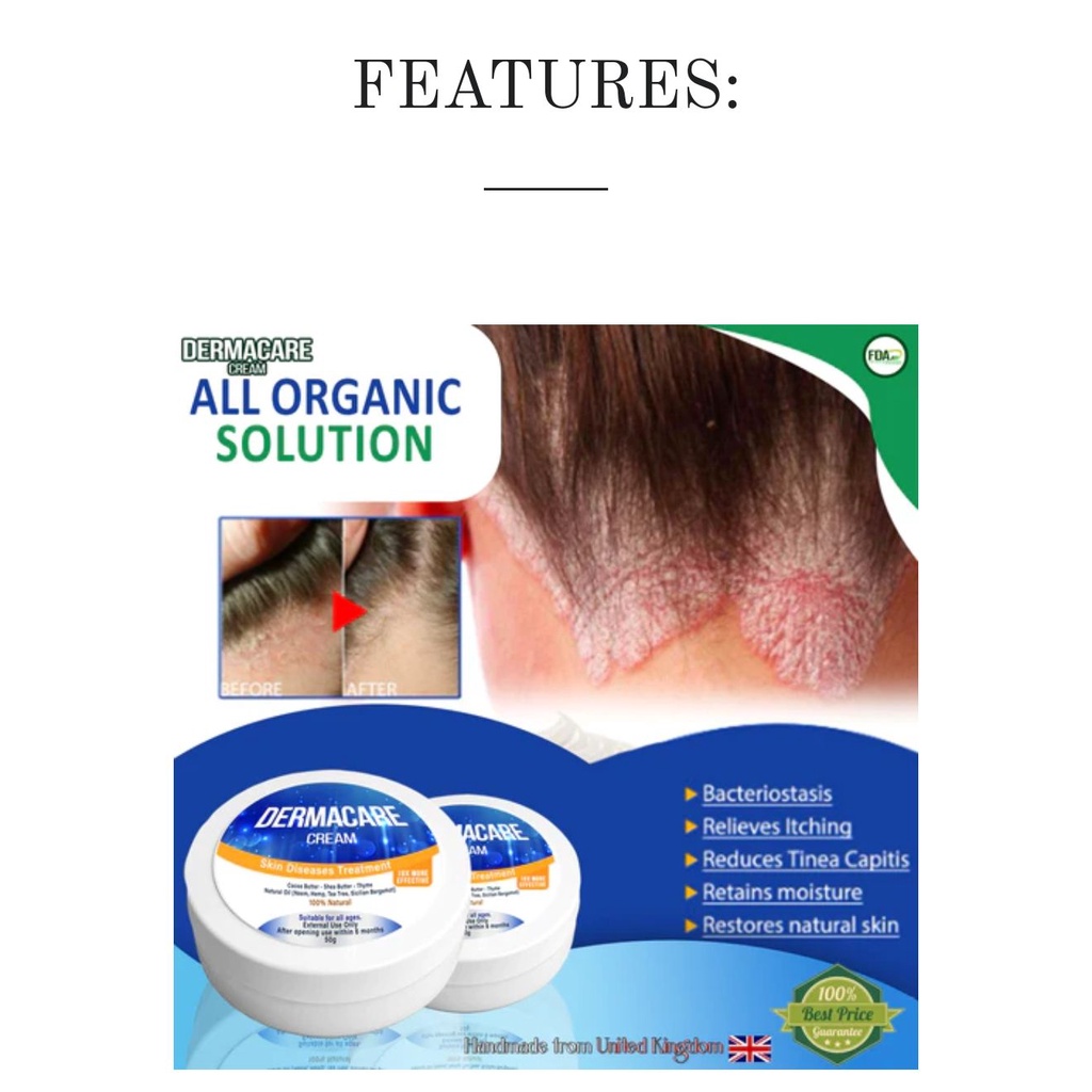 DERMACARE CREAM 50g (Treaent for Skin Diseases such as Eczema ...