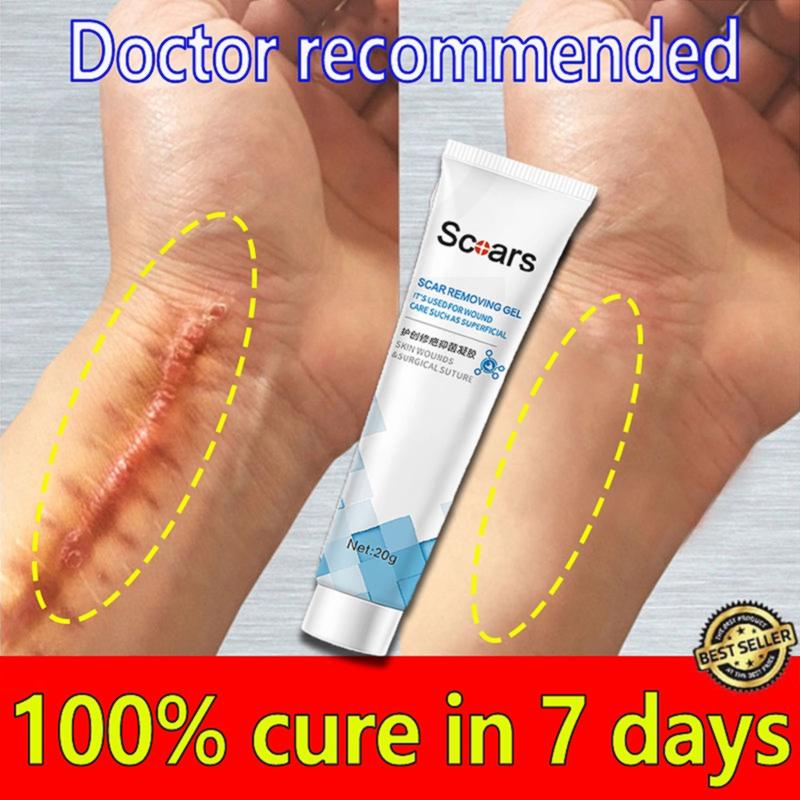 K56 Scar Remover Peklat For Old And New Scar Scarminator Cream Strech Mark Remover Pimple Scar 1985