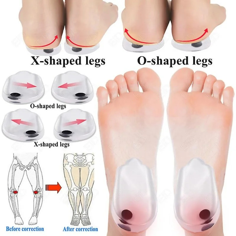 Silicone Gel Orthopedic Insoles for Feet Magnet Massage Insole O/X Leg ...