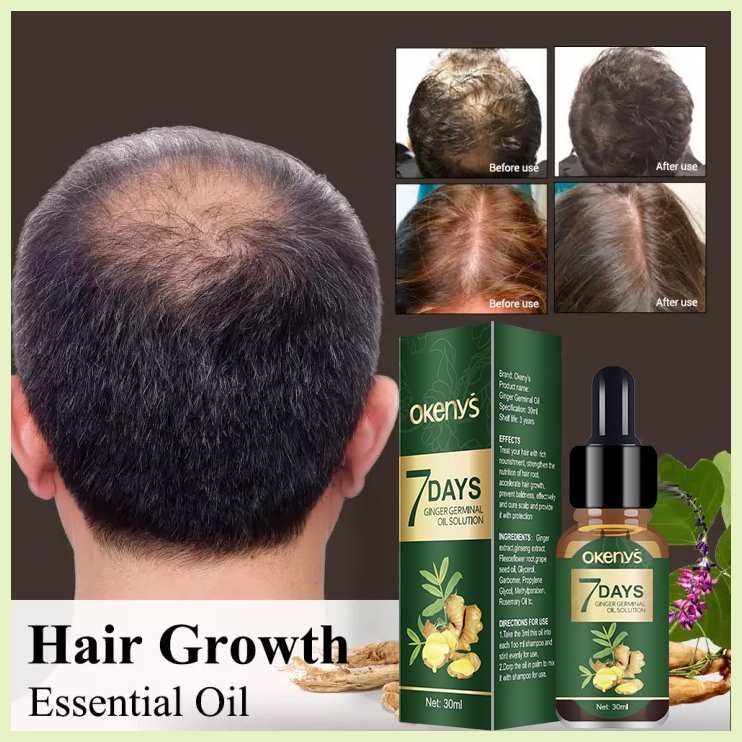 Hair&grower`PV&Eu`man&woman`vd&eX`spray&Fast`IL&hair growth Scalp ...