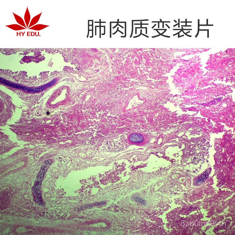 C0XP Lung Slice Biological Slice Microscope Biological Slice Set ...