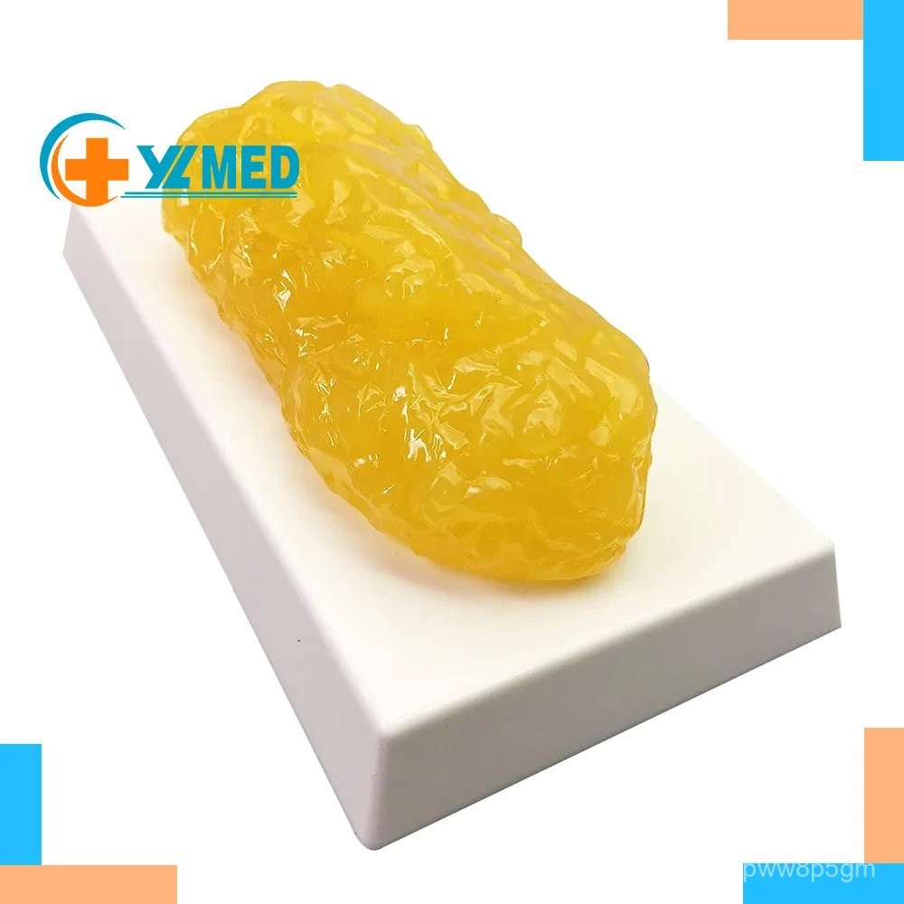 Human Body Fat Model 1lb Sciences Realistic Anatomic Fatty Tissue Model ...