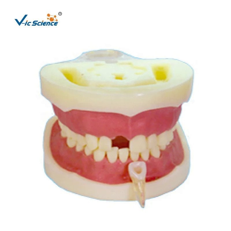medical science education model human root teeth model dental anatomy ...