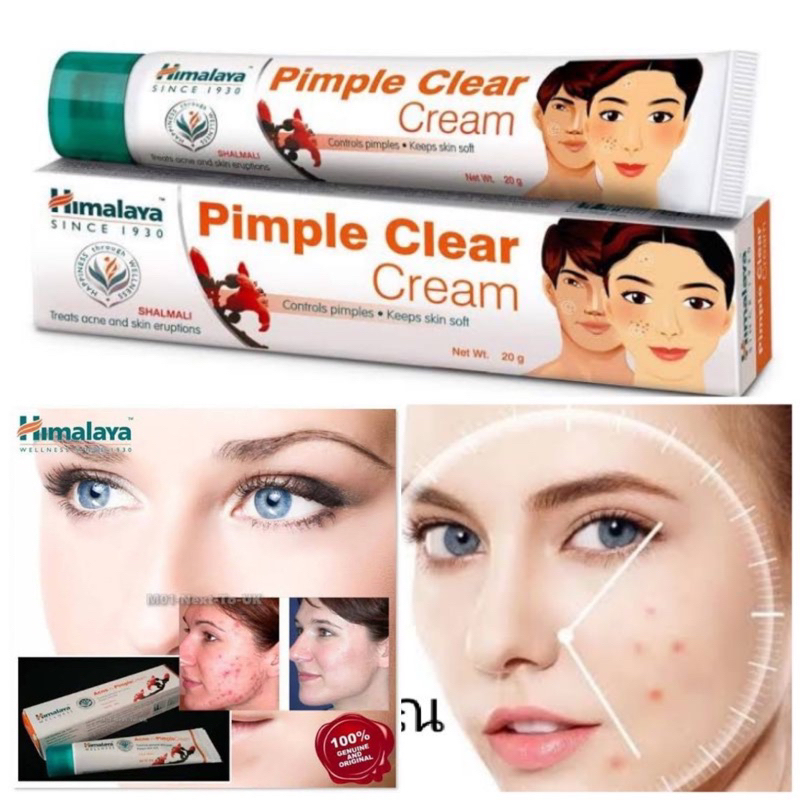 Himalaya Pimple Clear Cream Removes Scars Marks Pimples keeps Skin Soft