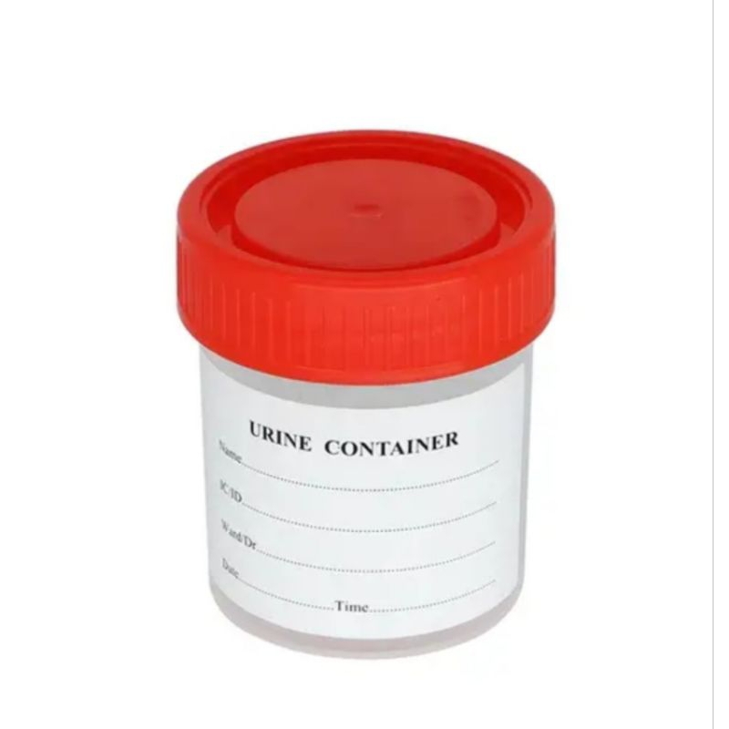 specimen-cup-urine-cup-stool-container-urine-sputum-sample-stool