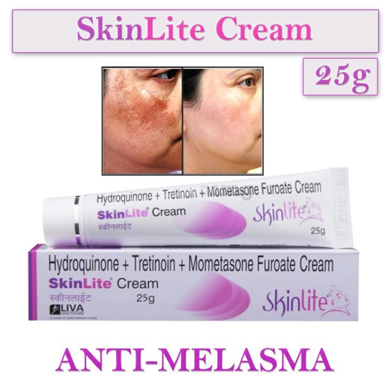 SKINLITE CREAM ORIGINAL 25g Shopee Philippines