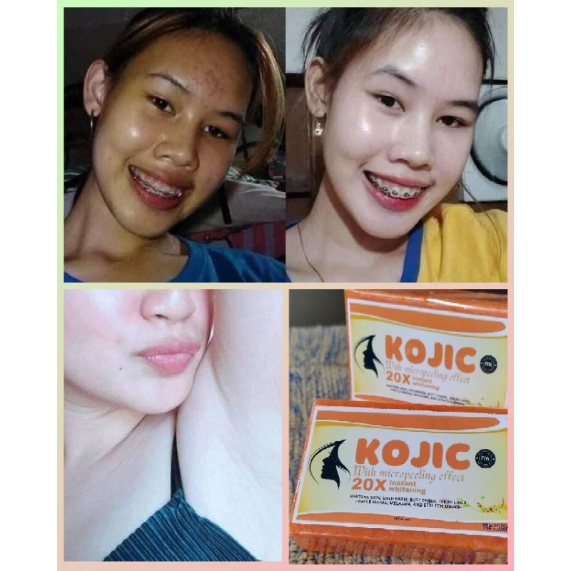 TRENDING KOJIC PAPAYA+GLUTATHIONE & COLLAGEN 120g | Shopee Philippines