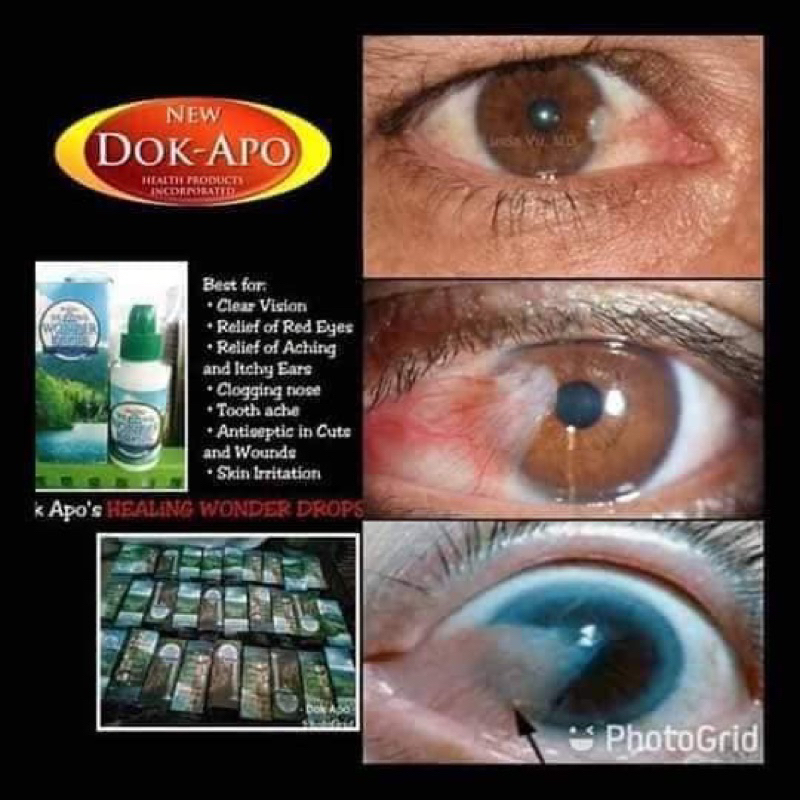 REFRESH EYE DROPS EFFECTIVE FOR EYES BLURRED VISION FDA APPROVED ANTI