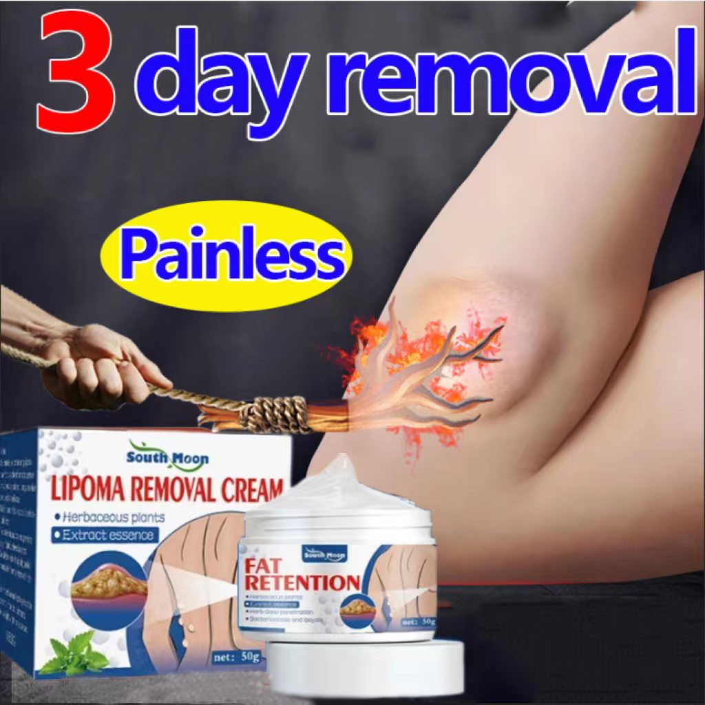 50g Lipoma Removal Cream For Relieving Fat Lumps Hard Lumps Bulge And Eliminating Fatty Tumor 