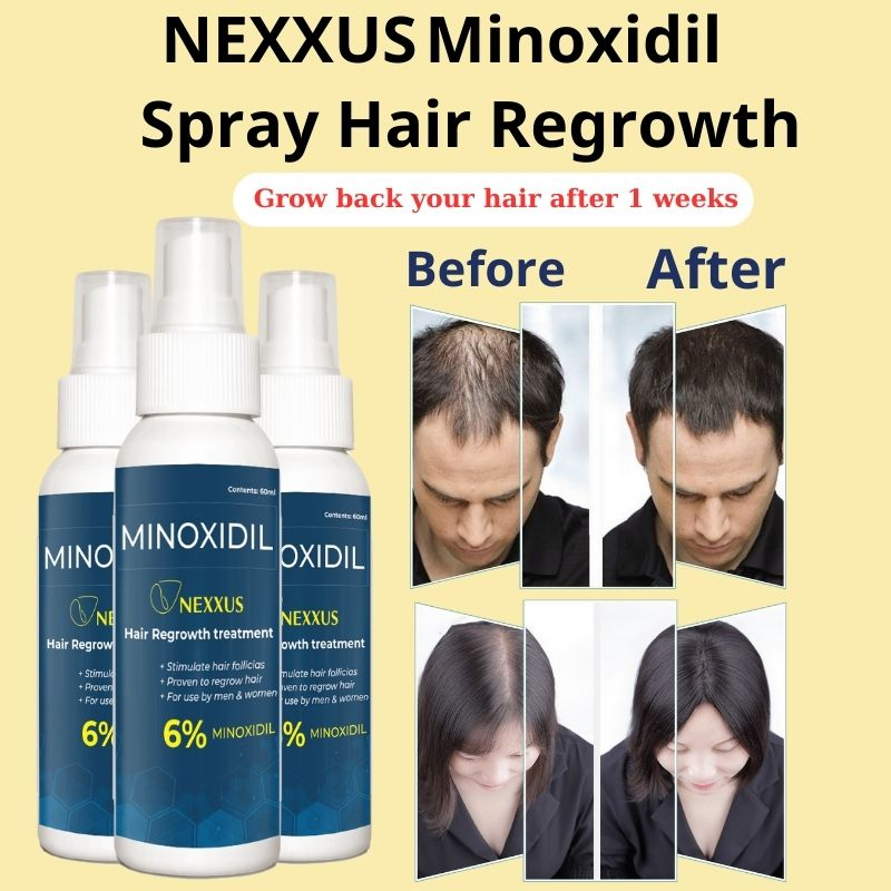 Nexxus Minoxidil spray regowth Minoxidil Hair Grower treatment ...