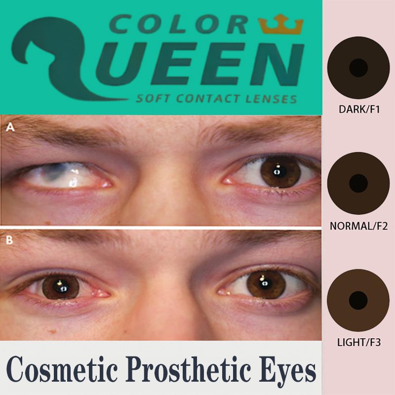 Prosthetic Contact Lens Eye Defects Iris Lenses aesthetic lenses Color ...