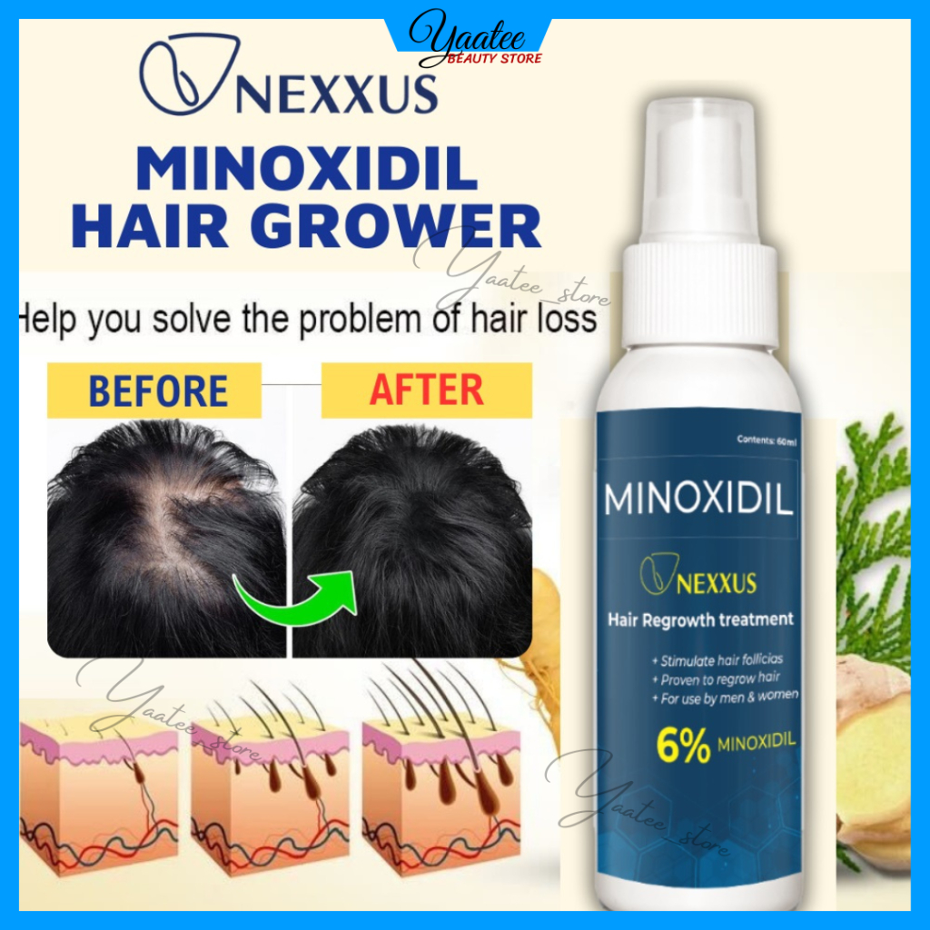 MINOXIDIL Hair Grower BEARD AND HAIR GROWTH SPRAY Nexxus Minoxidil ...