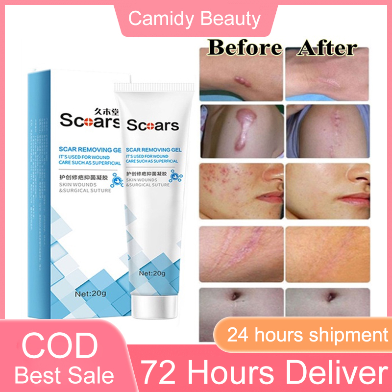 Stock Scar Remover Peklat Scarminator Cream Strech Mark Remover Pimple