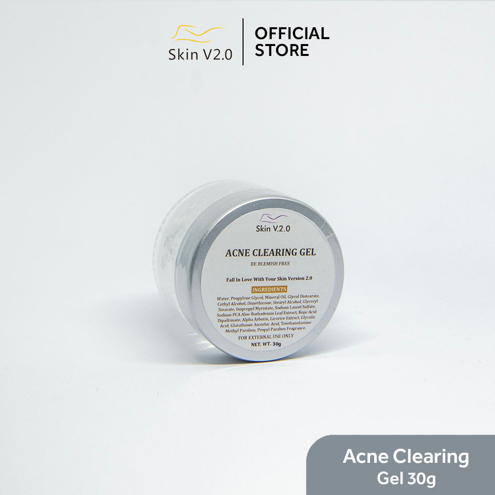 Skin V2.0 Anti Acne Cream Gel 30g | Shopee Philippines
