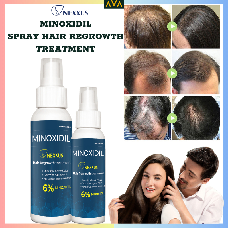 Minoxidil Hair Grower NEXXUS Minoxidil spray regrowth treatment ...