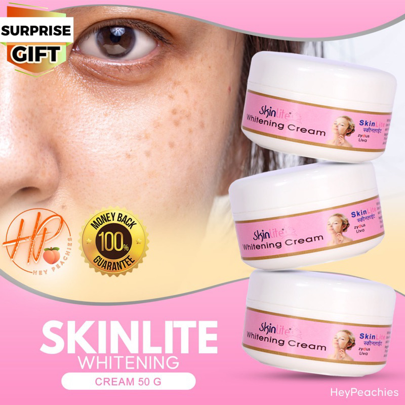 Skinlite Whitening cream TUB for Pekas Melasma dark spot and