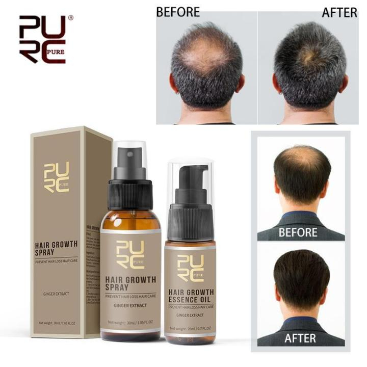 Purc Hair Growth Serum Rapid Hair Growth Spray Hair And Scalp Treatment