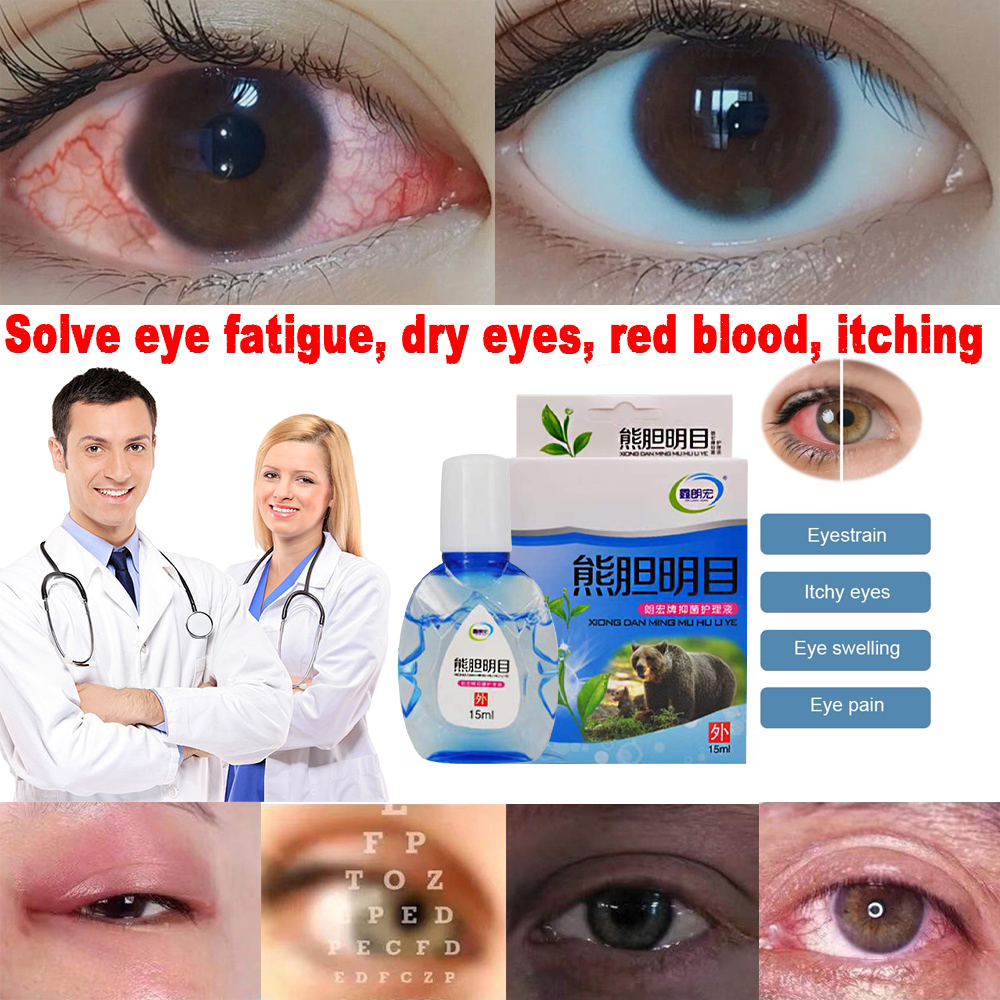 15ml Legit Eye Drops for Dry Eyes Relieves Itchy Eye Red Eye Visual