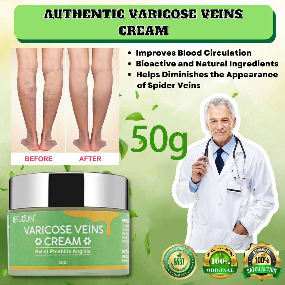 Sefudun Varicose Vein Treatment Cream Remover Spider Veins Pain Effective Cure Vasculitis