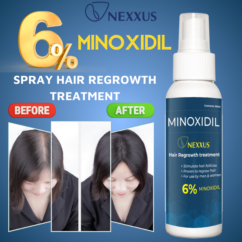 Nexxus Minoxidil Hair Grower Minoxidil spray regrowth treatment ...