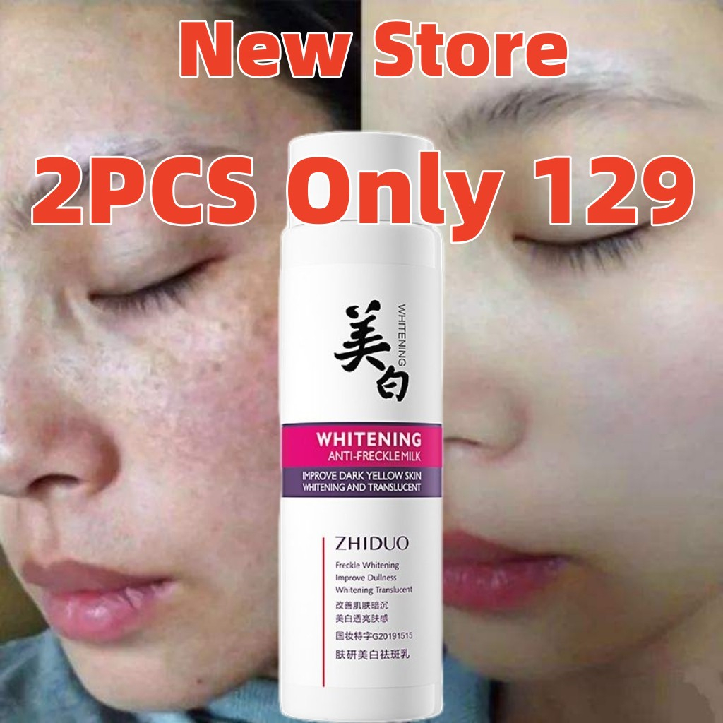 120ML Melasma Cream Lotion Remove Freckle Cream Whitening Cream Dark ...