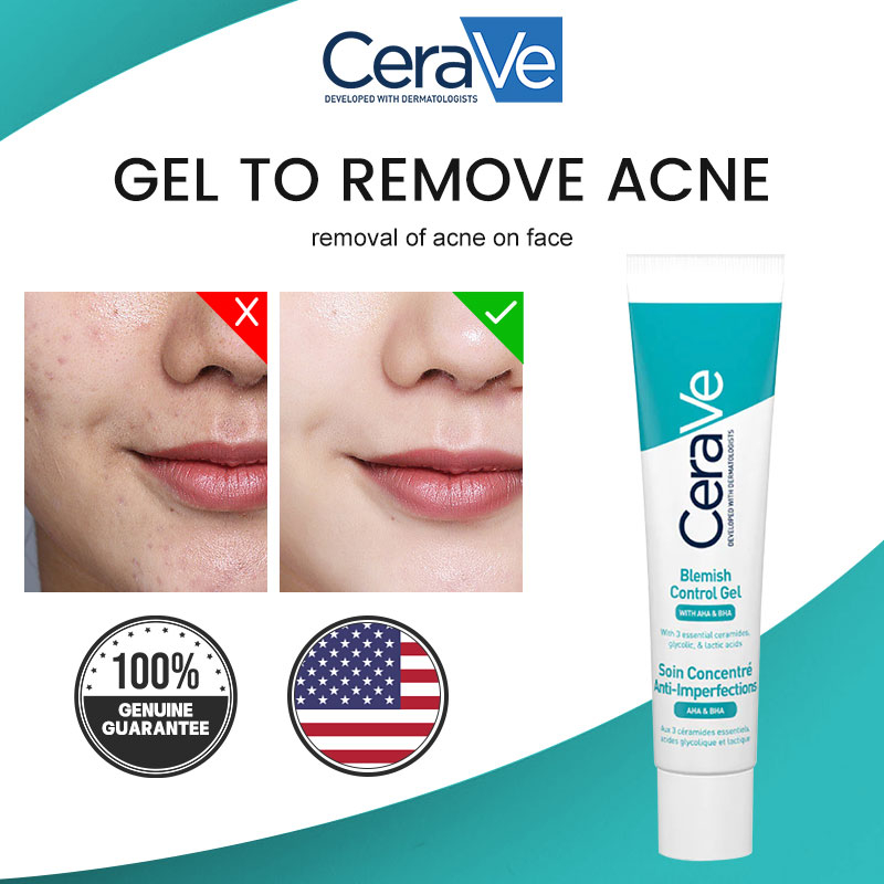 CeraVe Acne Control Gel, 2 SA Treatment watsons blackhead scar remover