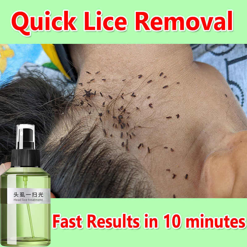 Head Lice Shampoo for Kids Head Lice Remover Anti and Eggs Lice Remover